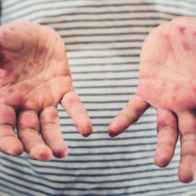 Idaho Crime Scene & Trauma Cleanup Services